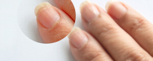 unhas de uma pessoa
