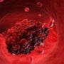 Coágulo de sangue