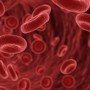 Anemia